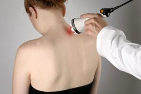 Laser Therapie