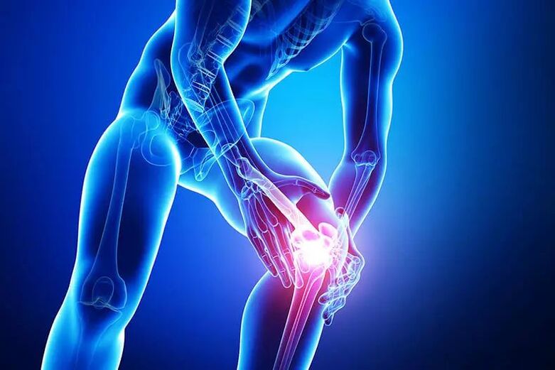 Symptomer vun Arthrosis