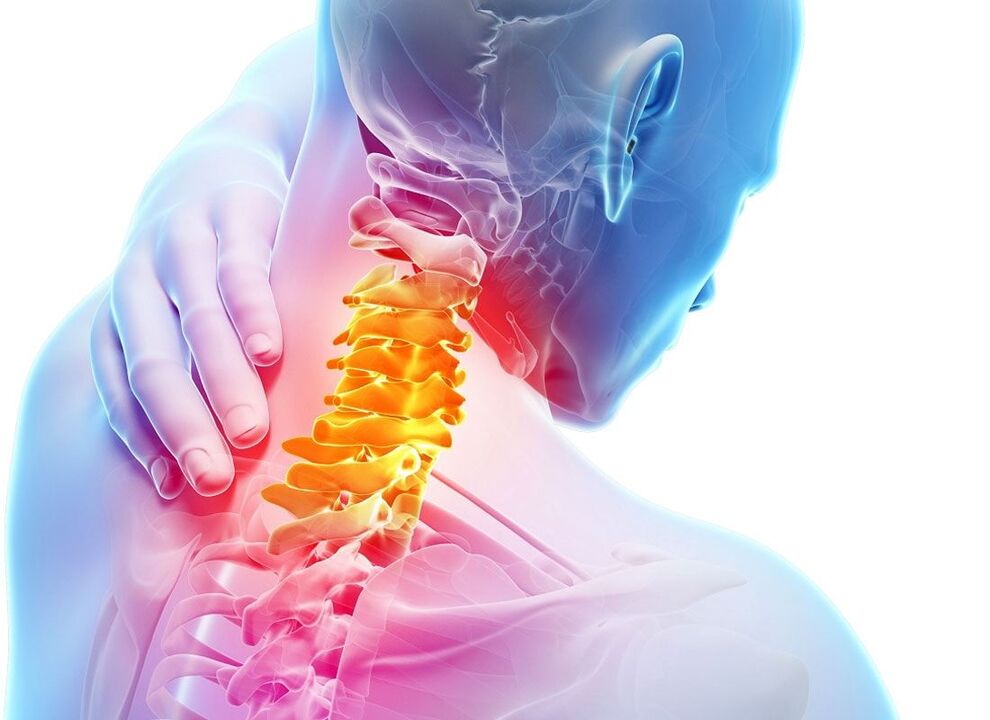 Osteochondrose vun der cervical Wirbelsäule